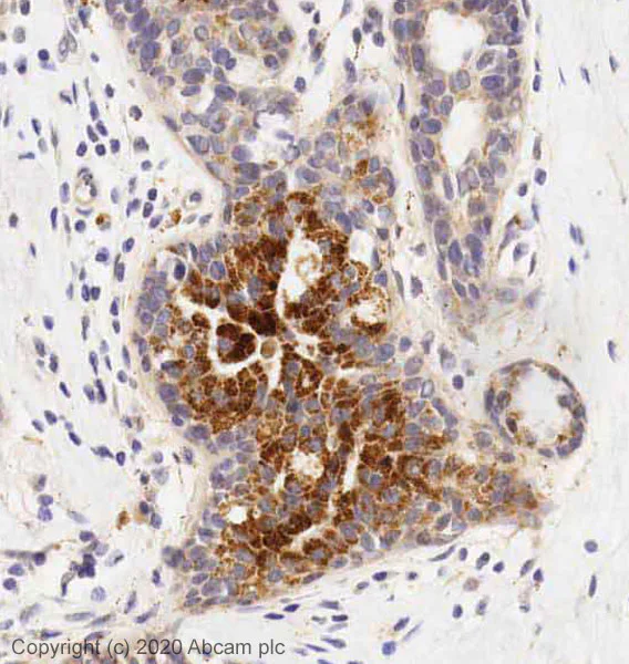 Immunohistochemistry (Formalin/PFA-fixed paraffin-embedded sections) - Anti-Thrombospondin 1 antibody (AB85762)