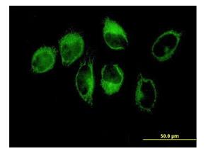 Immunocytochemistry/ Immunofluorescence - Anti-Thrombospondin 1 antibody (AB88529)