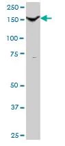 Western blot - Anti-Thrombospondin 1 antibody (AB88529)