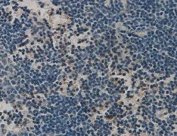 Immunohistochemistry (Formalin/PFA-fixed paraffin-embedded sections) - Anti-Thrombospondin 1 antibody (AB93653)