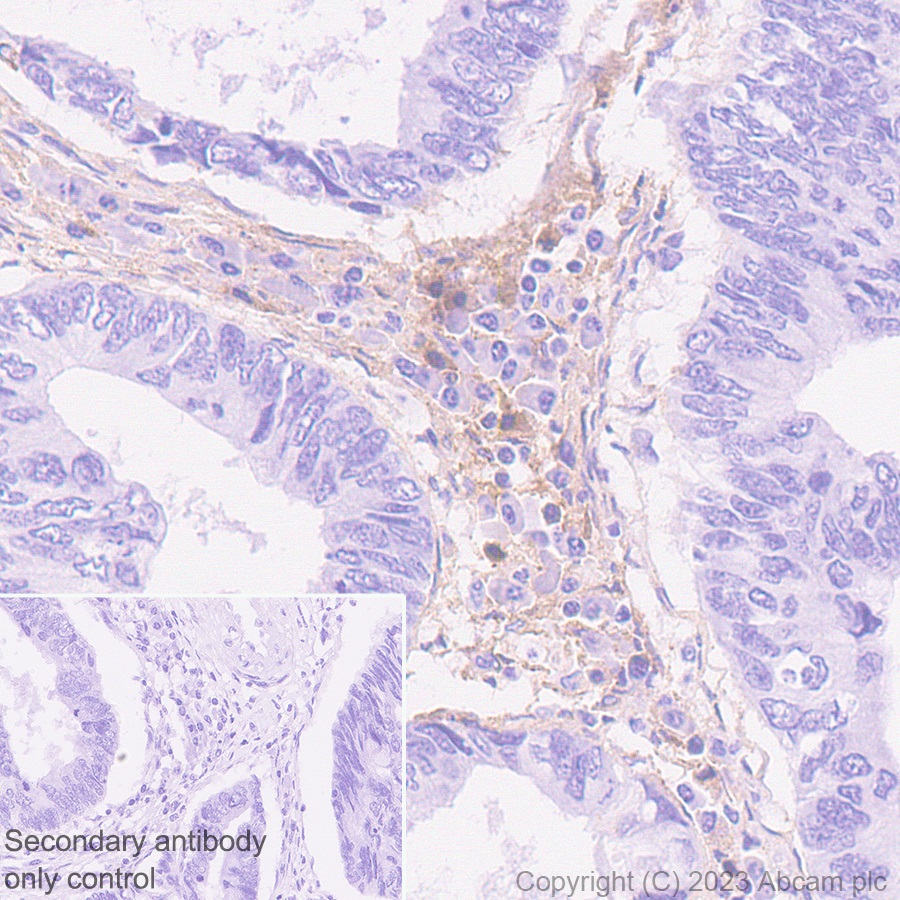 Immunohistochemistry (Formalin/PFA-fixed paraffin-embedded sections) - Anti-Thrombospondin 1 antibody [EPR22927-54] (ab267388), expandable thumbnail