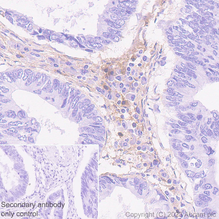 Immunohistochemistry (Formalin/PFA-fixed paraffin-embedded sections) - Anti-Thrombospondin 1 antibody [EPR22927-54] - BSA and Azide free (AB267397)