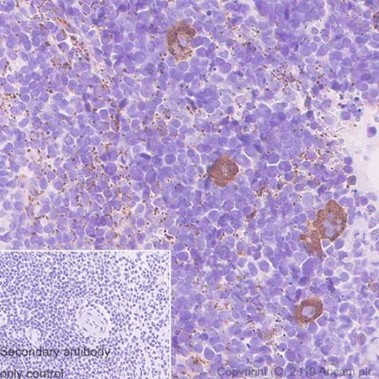 Immunohistochemistry (Formalin/PFA-fixed paraffin-embedded sections) - Anti-Thrombospondin 1 antibody [EPR22927-54] - BSA and Azide free (AB267397)
