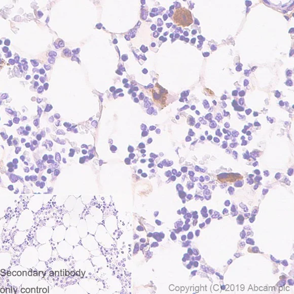 Immunohistochemistry (Formalin/PFA-fixed paraffin-embedded sections) - Anti-Thrombospondin 1 antibody [EPR22927-54] - BSA and Azide free (AB267397)