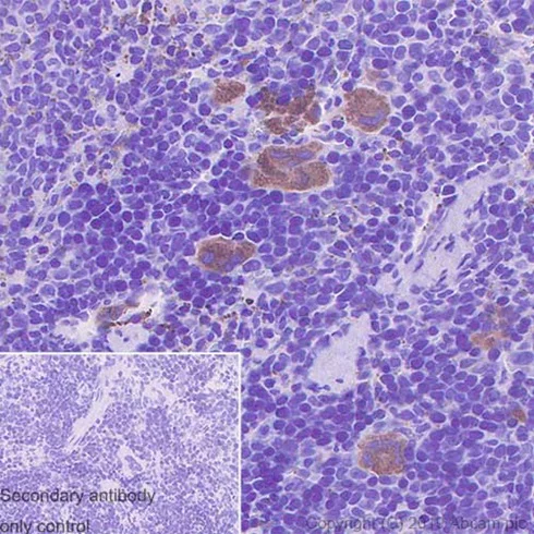 Immunohistochemistry (Formalin/PFA-fixed paraffin-embedded sections) - Anti-Thrombospondin 1 antibody [EPR22928-10] (AB263905)
