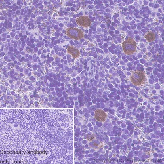 Immunohistochemistry (Formalin/PFA-fixed paraffin-embedded sections) - Anti-Thrombospondin 1 antibody [EPR22928-10] (AB263905)