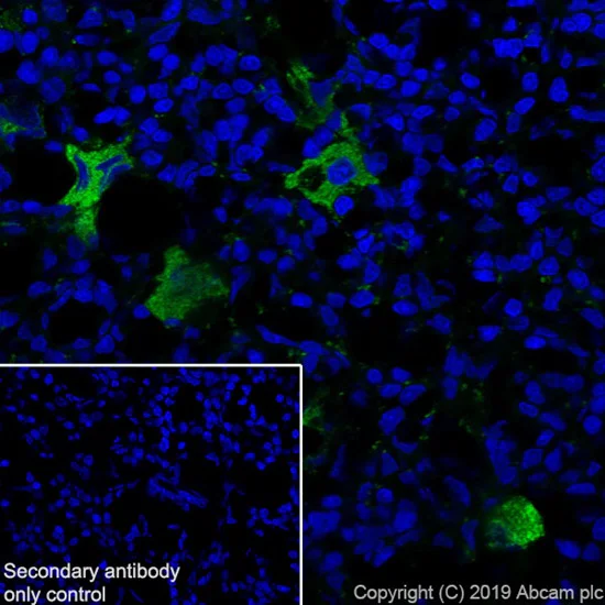 Immunohistochemistry (Frozen sections) - Anti-Thrombospondin 1 antibody [EPR22928-10] (AB263905)