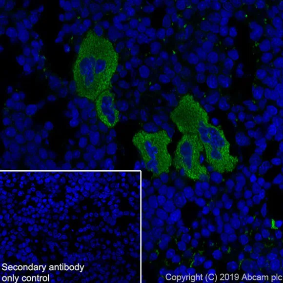 Immunohistochemistry (Frozen sections) - Anti-Thrombospondin 1 antibody [EPR22928-10] (AB263905)