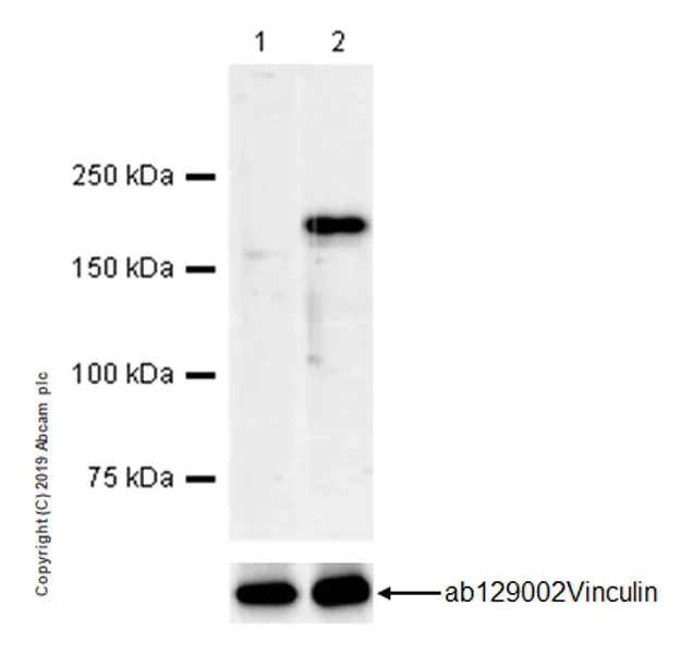 Western blot - Anti-Thrombospondin 1 antibody [EPR22928-10] (AB263905)