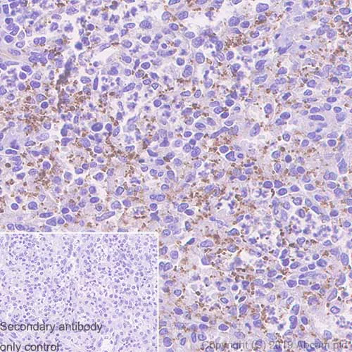 Immunohistochemistry (Formalin/PFA-fixed paraffin-embedded sections) - Anti-Thrombospondin 1 antibody [EPR22928-10] - BSA and Azide free (AB263952)