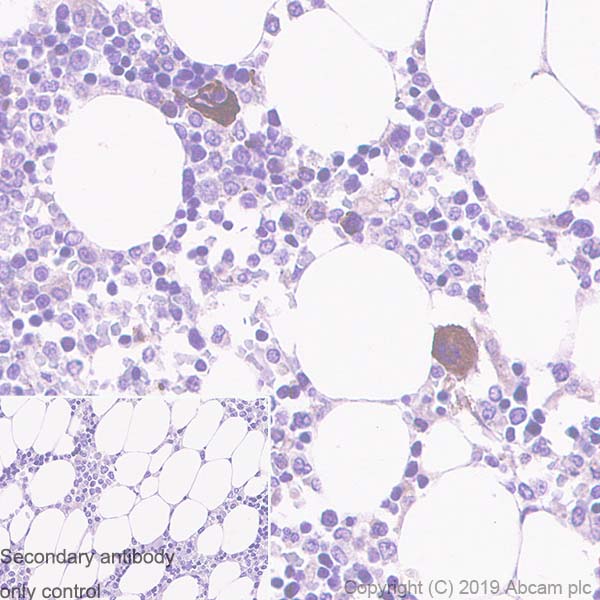 Immunohistochemistry (Formalin/PFA-fixed paraffin-embedded sections) - Anti-Thrombospondin 1 antibody [EPR22928-10] - BSA and Azide free (AB263952)