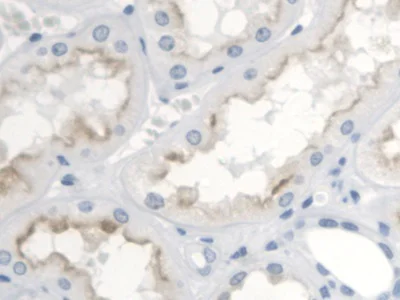 Immunohistochemistry (Formalin/PFA-fixed paraffin-embedded sections) - Anti-Thromboxane A2 receptor/TBXA2R antibody - Cytoplasm Marker (AB233288)