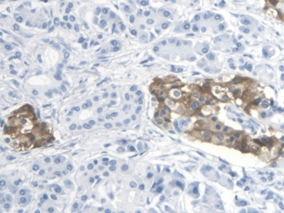 Immunohistochemistry (Formalin/PFA-fixed paraffin-embedded sections) - Anti-Thromboxane A2 receptor/TBXA2R antibody - Cytoplasm Marker (AB233288)