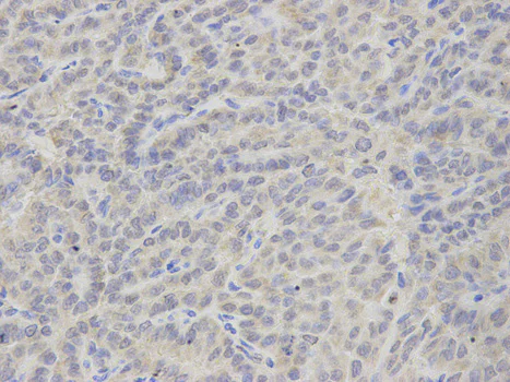 Immunohistochemistry (Formalin/PFA-fixed paraffin-embedded sections) - Anti-Thromboxane synthase antibody (AB187176)