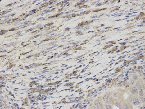 Immunohistochemistry (Formalin/PFA-fixed paraffin-embedded sections) - Anti-Thromboxane synthase antibody (AB187176)