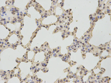 Immunohistochemistry (Formalin/PFA-fixed paraffin-embedded sections) - Anti-Thromboxane synthase antibody (AB187176)