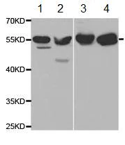 Western blot - Anti-Thromboxane synthase antibody (AB187176)