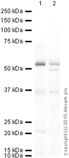 Western blot - Anti-Thromboxane synthase antibody (AB39362)