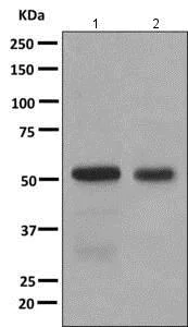Western blot - Anti-Thromboxane synthase antibody [EPR7333(2)] - BSA and Azide free (AB249344)
