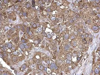 Immunohistochemistry (Formalin/PFA-fixed paraffin-embedded sections) - Anti-ThrRS antibody (AB101486)