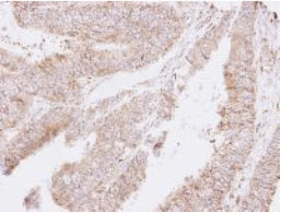 Immunohistochemistry (Formalin/PFA-fixed paraffin-embedded sections) - Anti-ThrRS antibody (AB126179), expandable thumbnail