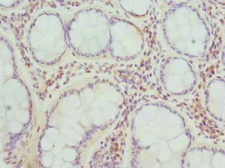 Immunohistochemistry (Formalin/PFA-fixed paraffin-embedded sections) - Anti-ThrRS antibody (AB236903)