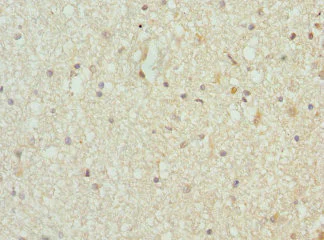 Immunohistochemistry (Formalin/PFA-fixed paraffin-embedded sections) - Anti-ThrRS antibody (AB236903)