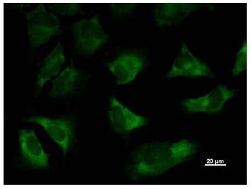Immunocytochemistry - Anti-ThrRS antibody [TARSF8H3] (AB50795)
