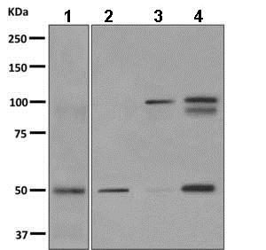 Western blot - Anti-THSD1 antibody [EPR9506] - BSA and Azide free (AB249268)
