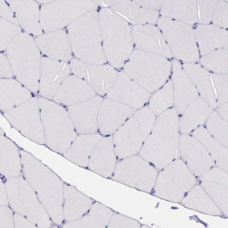 Immunohistochemistry (Formalin/PFA-fixed paraffin-embedded sections) - Anti-THSD7A antibody (AB121122)