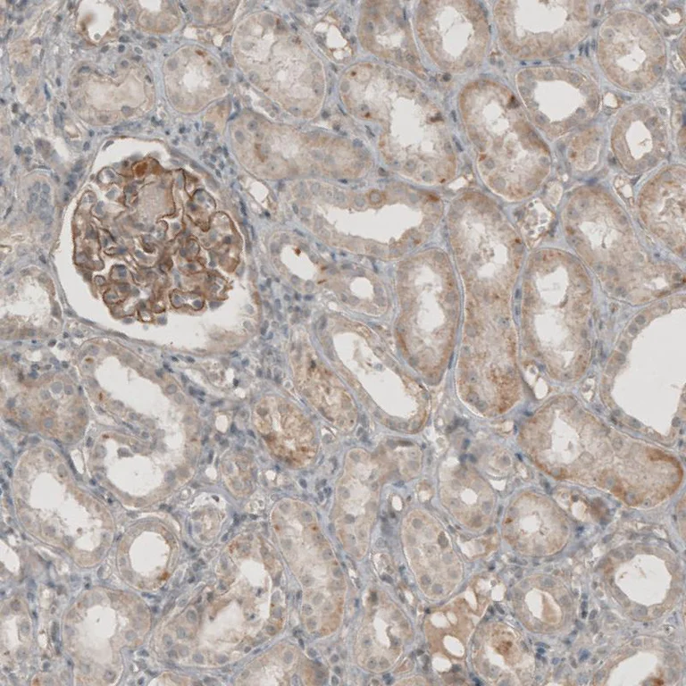 Immunohistochemistry (Formalin/PFA-fixed paraffin-embedded sections) - Anti-THSD7A antibody (AB121122)