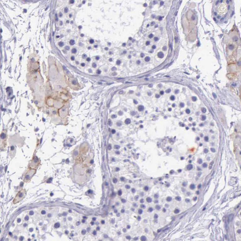 Immunohistochemistry (Formalin/PFA-fixed paraffin-embedded sections) - Anti-THSD7A antibody (AB121122)