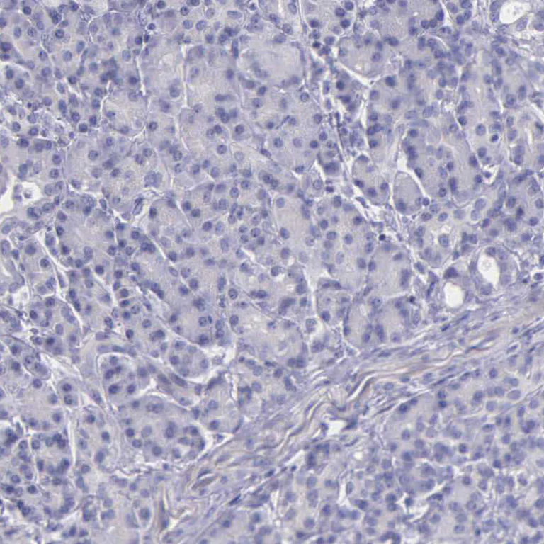 Immunohistochemistry (Formalin/PFA-fixed paraffin-embedded sections) - Anti-THSD7A antibody (AB121122)