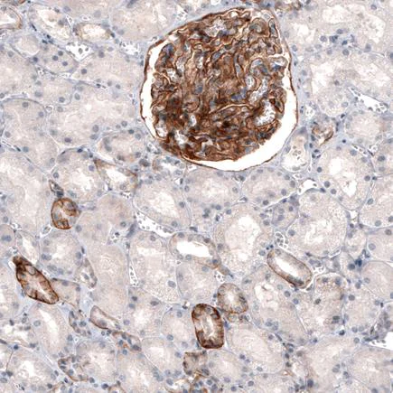Immunohistochemistry (Formalin/PFA-fixed paraffin-embedded sections) - Anti-THSD7A antibody [CL3778] (AB243031)
