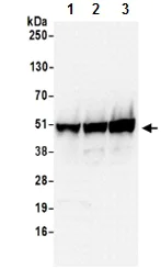 Western blot - Anti-THUMPD1 antibody (AB199850)