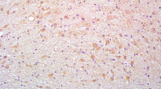 Immunohistochemistry (Formalin/PFA-fixed paraffin-embedded sections) - Anti-Thy1.1 antibody (AB203022)