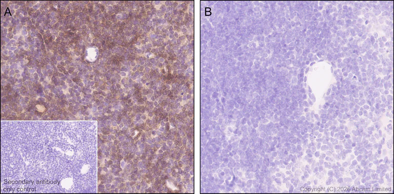Immunohistochemistry (Formalin/PFA-fixed paraffin-embedded sections) - Anti-Thy1.1 antibody [EPR31142-29] (AB326876)
