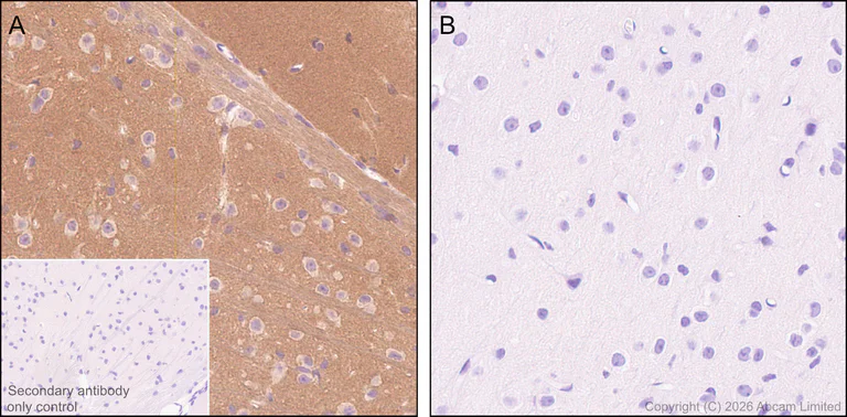 Immunohistochemistry (Formalin/PFA-fixed paraffin-embedded sections) - Anti-Thy1.1 antibody [EPR31142-29] (AB326876)