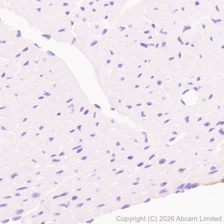 Immunohistochemistry (Formalin/PFA-fixed paraffin-embedded sections) - Anti-Thy1.1 antibody [EPR31142-29] (AB326876)