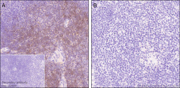 Immunohistochemistry (Formalin/PFA-fixed paraffin-embedded sections) - Anti-Thy1.1 antibody [EPR31142-29] - BSA and Azide free (AB326882)