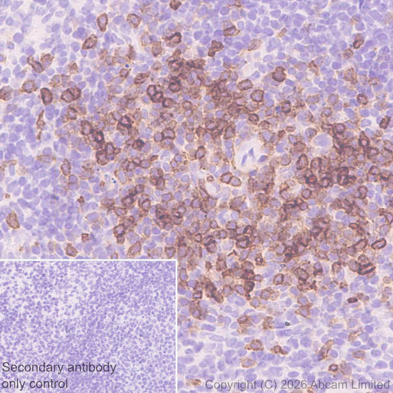 Immunohistochemistry (Formalin/PFA-fixed paraffin-embedded sections) - Anti-Thy1.2 antibody [EPR31143-526] (AB325921)