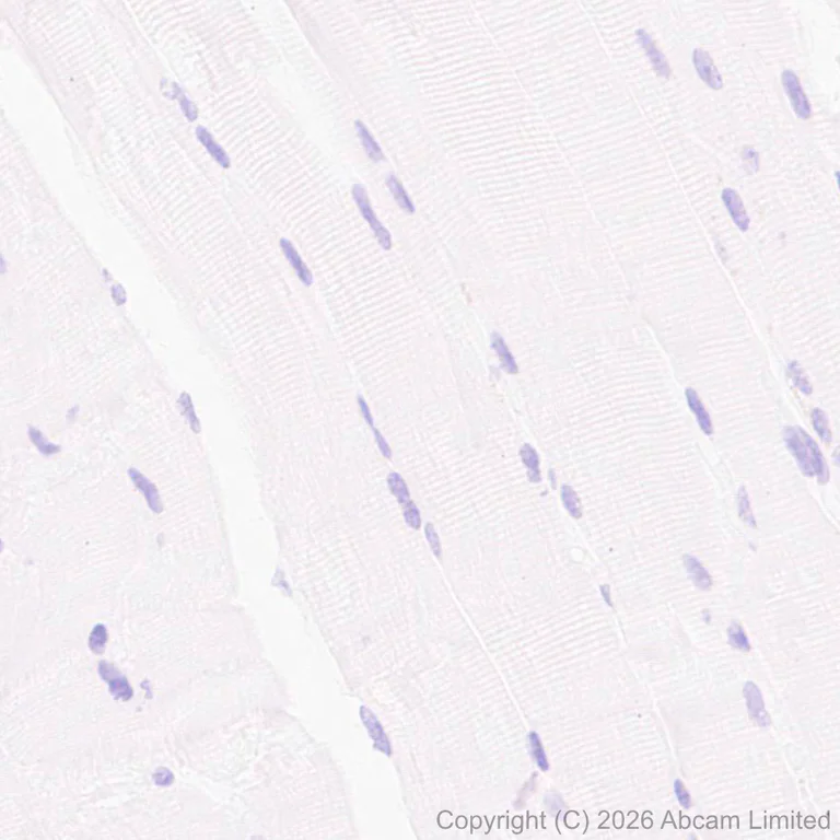 Immunohistochemistry (Formalin/PFA-fixed paraffin-embedded sections) - Anti-Thy1.2 antibody [EPR31143-526] (AB325921)