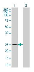 Western blot - Thymidine Kinase 1 overexpression 293T lysate (whole cell) (AB94157)
