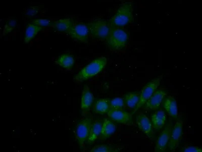 Immunocytochemistry/ Immunofluorescence - Anti-Thymidine Kinase 1/TK1 antibody [C1] (AB239509)