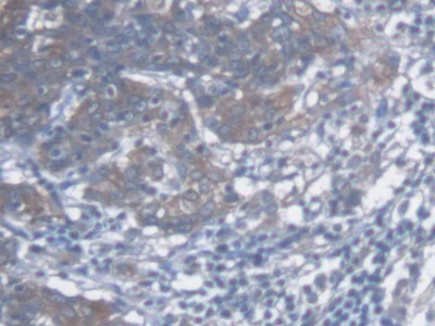 Immunohistochemistry (Formalin/PFA-fixed paraffin-embedded sections) - Anti-Thymidine Kinase 1/TK1 antibody [C1] (AB239509)