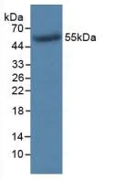 Western blot - Anti-Thymidine Kinase 1/TK1 antibody [C1] (AB239509)