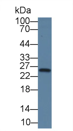 Western blot - Anti-Thymidine Kinase 1/TK1 antibody [C1] (AB239509)