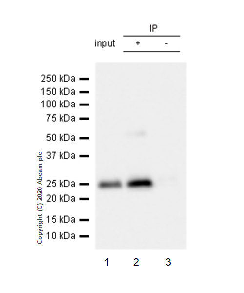 Immunoprecipitation - Anti-Thymidine Kinase 1/TK1 antibody [EPR3193] (AB76495), expandable thumbnail