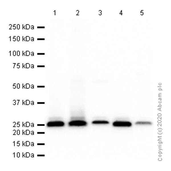 Western blot - Anti-Thymidine Kinase 1/TK1 antibody [EPR3193] (AB76495)