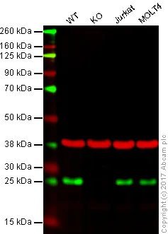 Western blot - Anti-Thymidine Kinase 1/TK1 antibody [EPR3193] (AB76495)